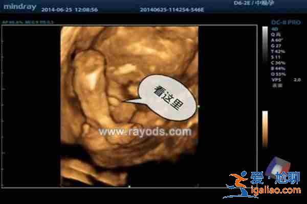 正規(guī)助孕包性別，第一助孕資訊？