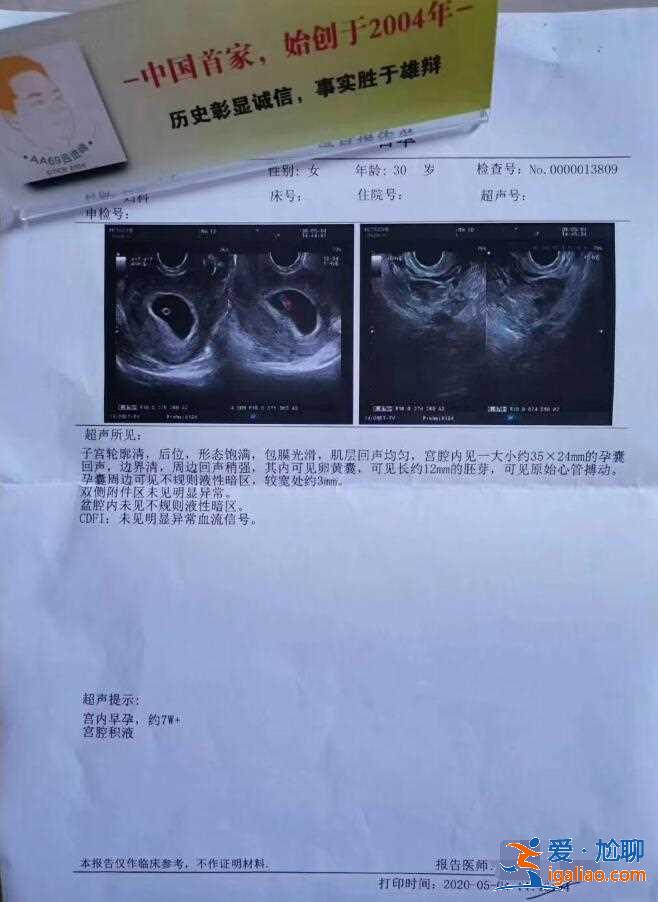 探索合肥試管嬰兒捐卵【頂尖醫(yī)療團(tuán)隊(duì)】？