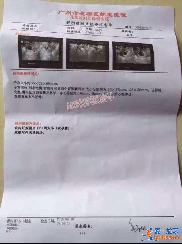看一下蘭州最大的助孕公司,100%包成功？