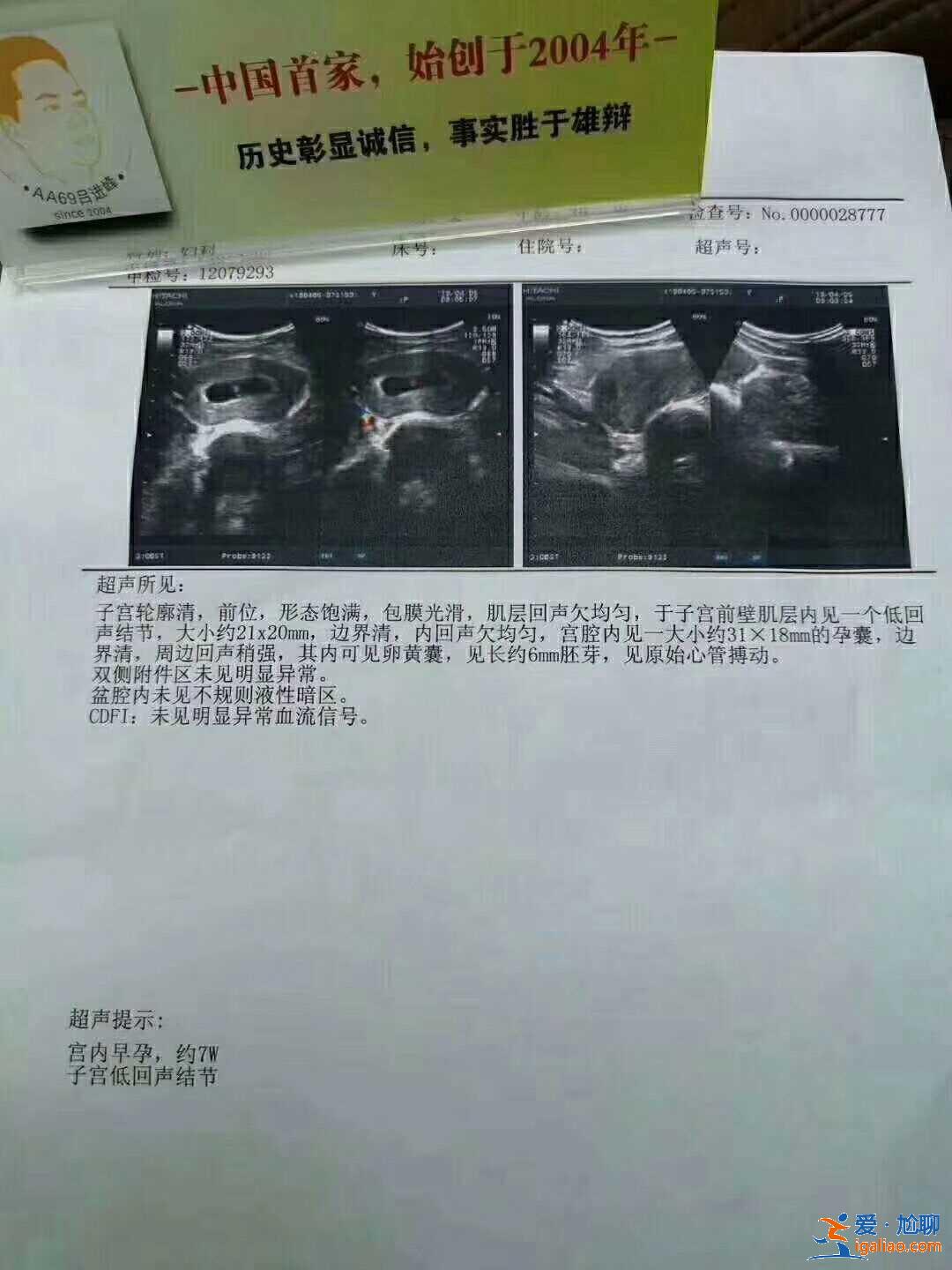 哈爾濱供卵助孕試管,怎樣才能做好優(yōu)生優(yōu)育？