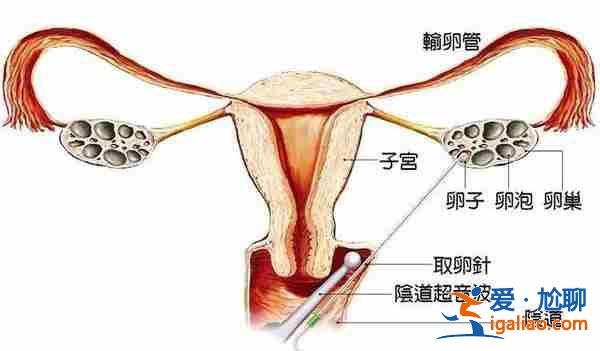 解說一下石家莊代生懷孕公司[ 1w多成功案例 ]？