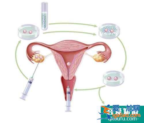 試管嬰兒的自然周期適合哪些人群？？