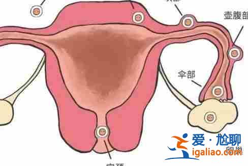 南通代生寶寶[ 技術(shù)介紹 ]？