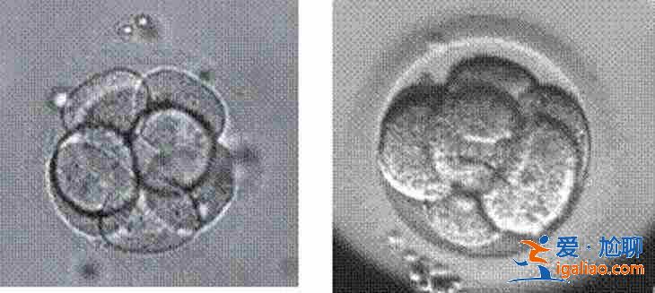 解說(shuō)一下杭州最大助孕公司,一次成功？