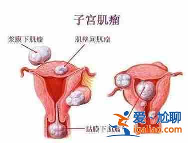 說一下北京代生懷孕公司【行業(yè)領(lǐng)跑】？