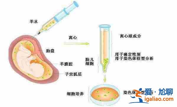 上海代生男孩費(fèi)用-孕媽媽最值得信賴的助孕公司？