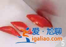 雞丁炒山藥怎么做？？
