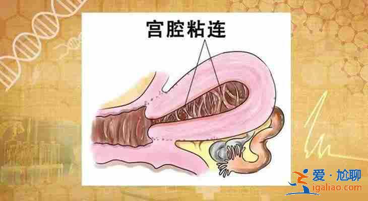 天津代生助孕[ 高端技術(shù)三甲助孕 ]？