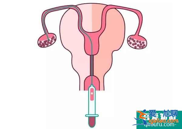 試管嬰兒促排卵與乳腺癌之間到底有沒有關(guān)系？？
