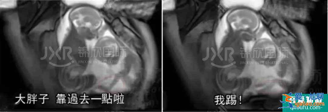 試管專家告訴你：如何懷雙胞胎，你懷雙胎的幾率高嗎？？