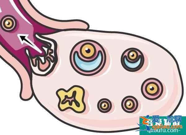 泰國試管嬰兒促排卵，會增加乳腺癌的患病幾率嗎?？