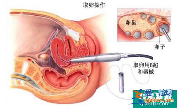 泰國(guó)試管嬰兒周期安全性高，主要體現(xiàn)在以下三個(gè)方面？