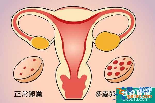 泰國(guó)試管嬰兒專家：探究引起不孕癥的原因與好孕方案？