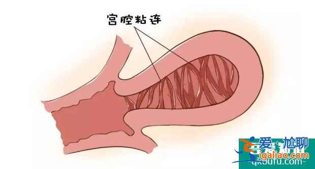 泰國(guó)試管嬰兒專家：探究引起不孕癥的原因與好孕方案？