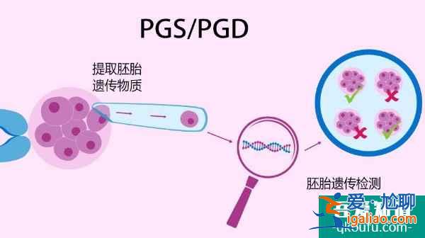 先天性輸精管缺如，去泰國(guó)做試管嬰兒如何成就“爸”業(yè)？？