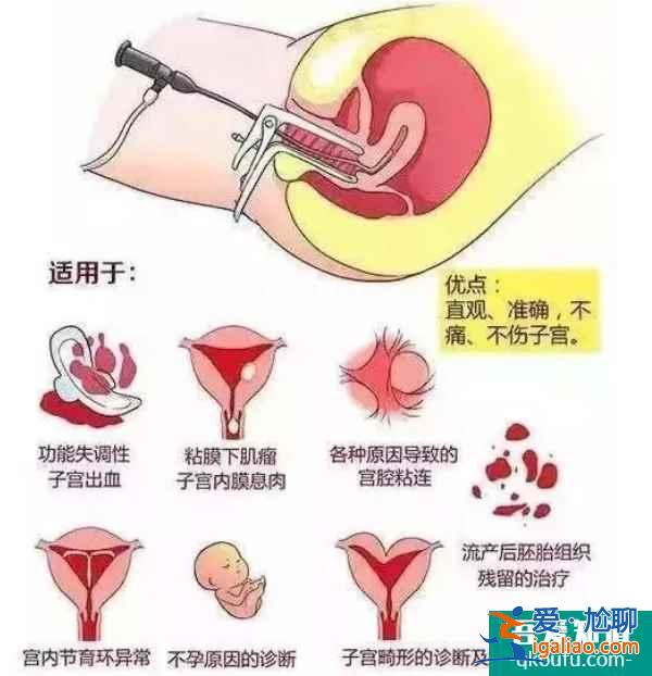 解惑：赴美做試管嬰兒還需要做宮腔鏡檢查嗎？？