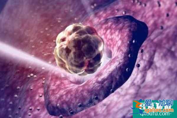 試管嬰兒專家：需要赴美幾次，根據(jù)具體方案而定？