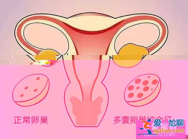卵泡發(fā)育不良如何通過第三代試管嬰兒助孕成功？