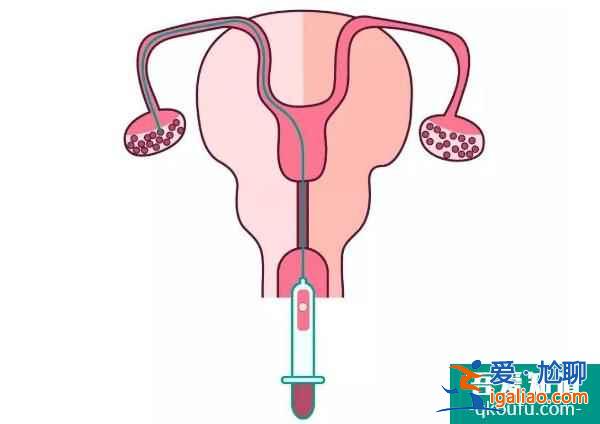 解析：試管嬰兒促排與乳腺癌之間有關(guān)系嗎?？