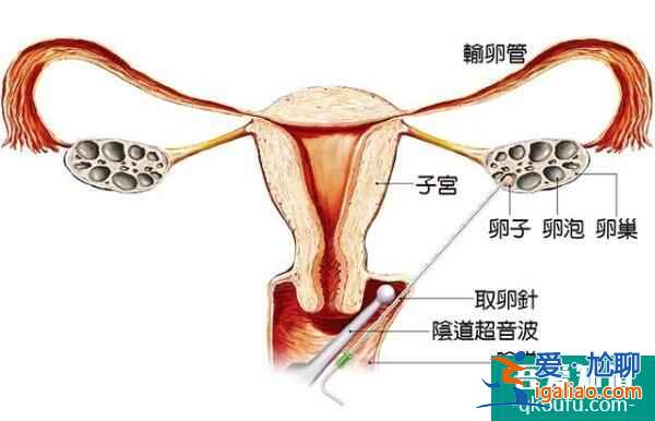 解讀：人工授精與試管嬰兒技術(shù)的區(qū)別與優(yōu)勢對比？