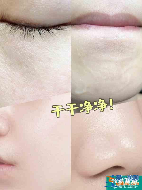 女明星的護(hù)膚方法解決了我的痘痘痘印問(wèn)題??？