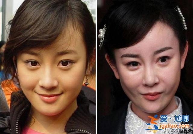 盤點那些整容的女明星 有的美若天仙臺 有人臉僵如石