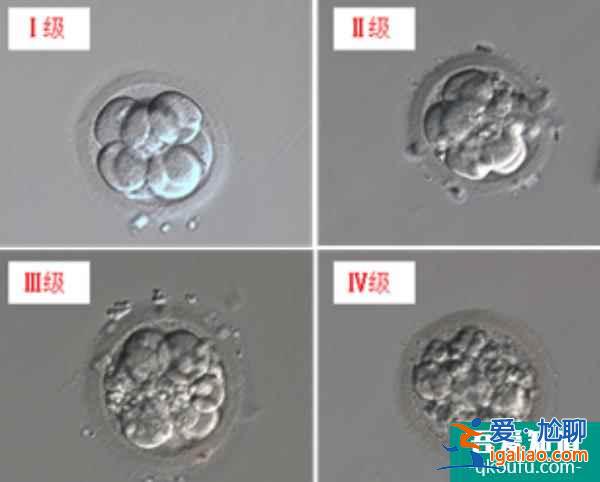 解析赴美做試管嬰兒胚胎級(jí)別與成功率的關(guān)系？