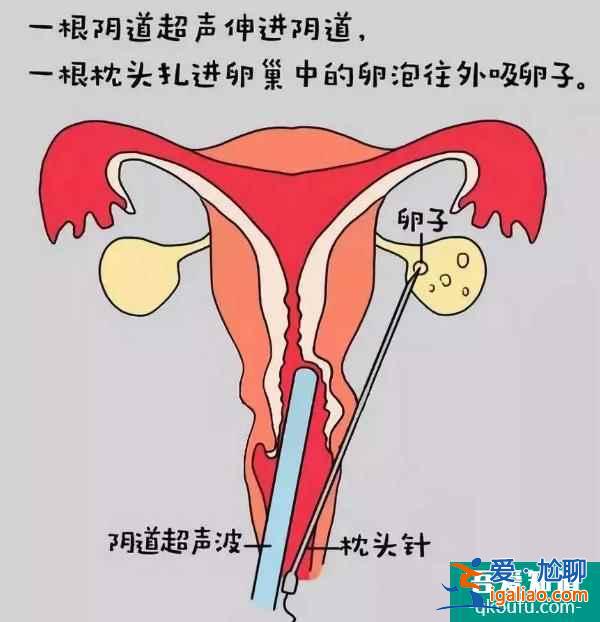 試管嬰兒寶寶能自然分娩嗎？誕生歷程是怎樣？？