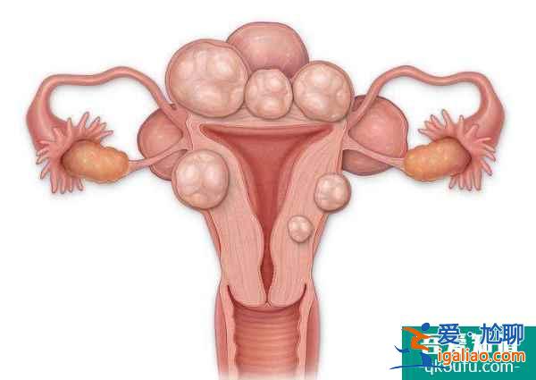 四類不孕女性的好孕錦囊—試管嬰兒？