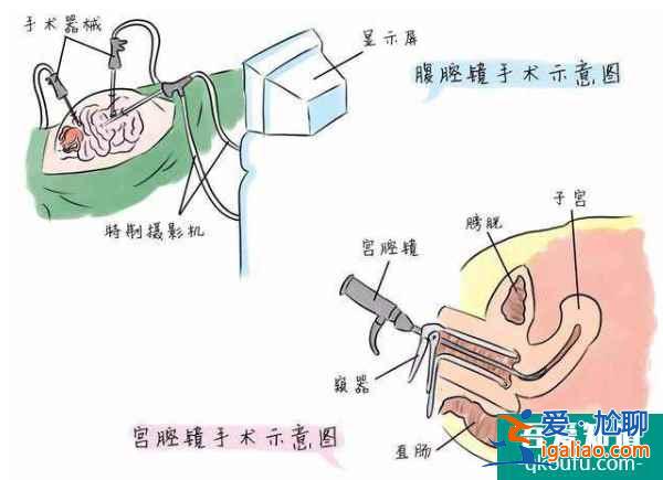 子宮息肉切除后，赴美做試管嬰兒的三大好孕對策？