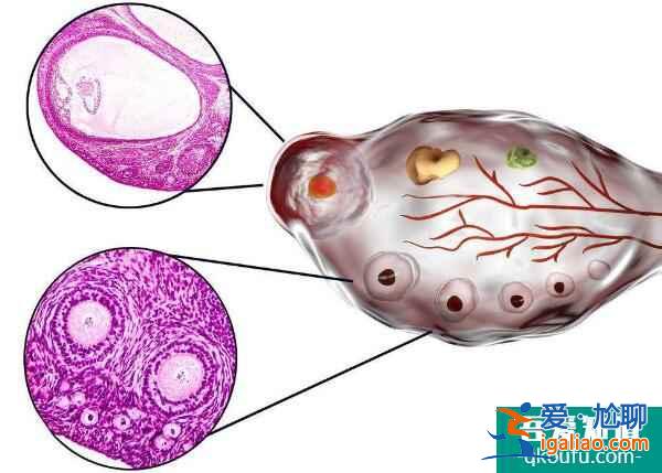 解析：影響試管嬰兒費(fèi)用的因素有哪些？？