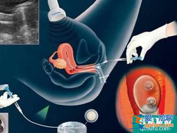 去做試管嬰兒，有陰道炎影響取卵嗎？？
