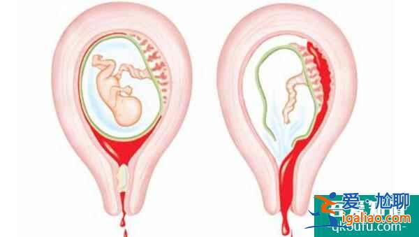 失獨(dú)家庭面臨哪些生育困境？試管嬰兒重獲生育希望？