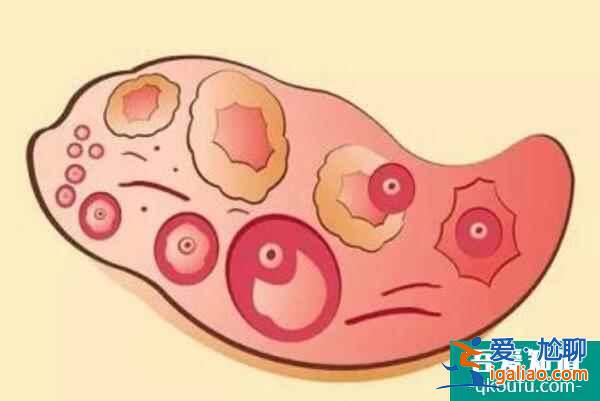 生命：赴美試管嬰兒抽血檢查項(xiàng)目及意義分析？