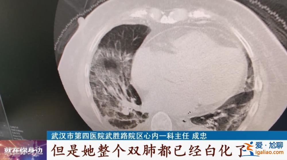 老人陽(yáng)了一定要及時(shí)查血氧？