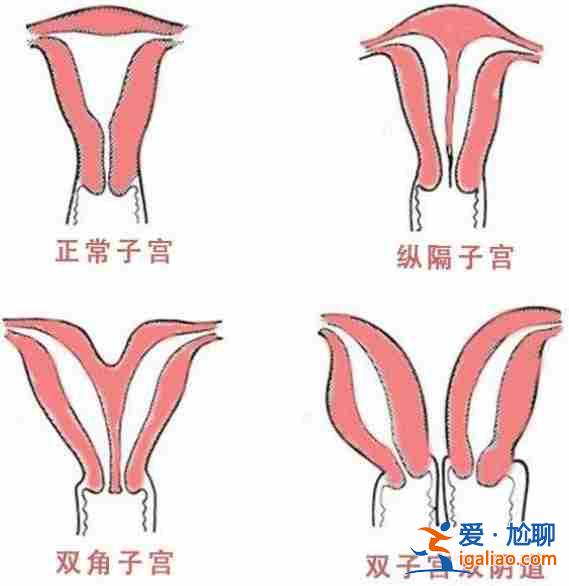 〖焦點(diǎn)〗替生孩子有嗎？