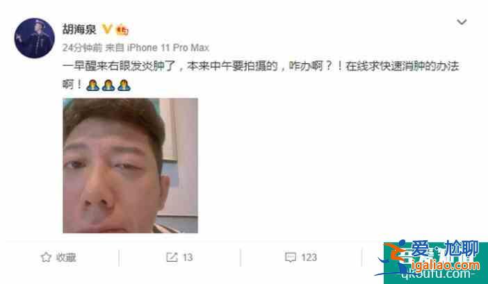 胡海泉右眼發(fā)炎紅腫 吃力半睜右眼盡顯疲憊十足？