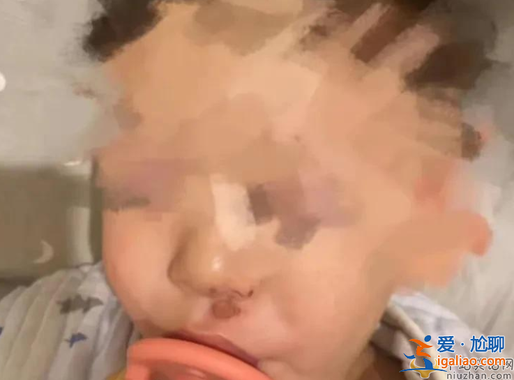 張恒指控鄭爽虐童!孩子手指撕裂縫數(shù)針 視頻曝光孩子語出驚人