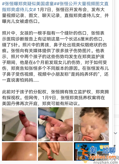 張恒指控鄭爽虐童!孩子手指撕裂縫數(shù)針 視頻曝光孩子語出驚人