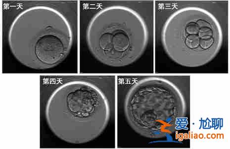 今日〖第三代試管嬰兒成功率高嗎〗高齡助孕呂進(jìn)峰生子助孕公司？