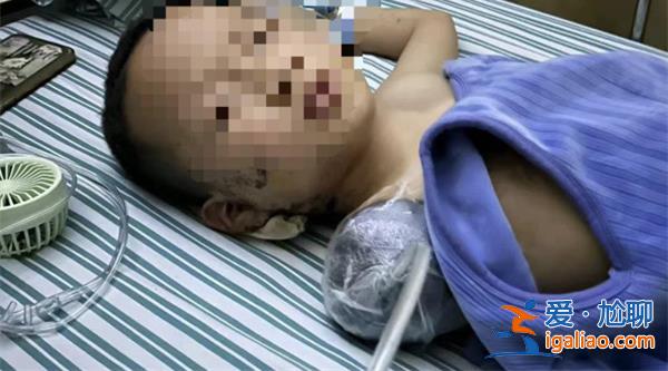 7歲男童被炮仗扎傷手臂截止，當?shù)鼐揭呀?jīng)展開調(diào)查[警方]？