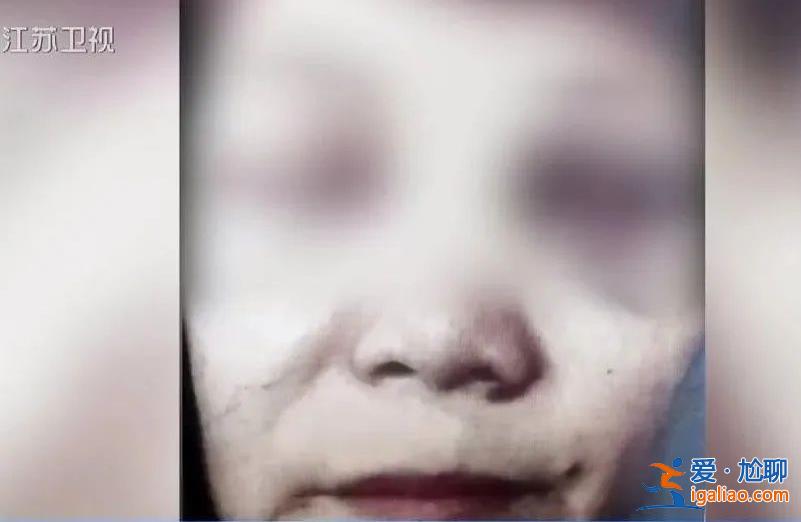 旁觀了兩眼就敢做手術？女子自學醫(yī)美 手術致人8級傷殘？