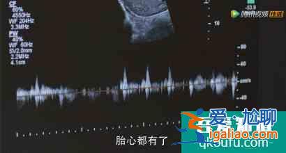《三十而已》戳心的不是顧佳的爽文感，而是編劇隱藏的兵荒馬亂？