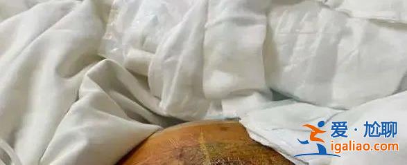 6次手術(shù)花上百萬元 現(xiàn)在還躺在醫(yī)院？