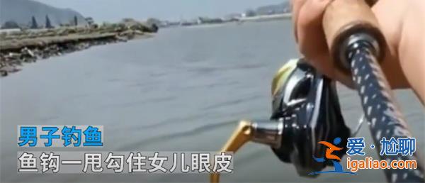 男子釣魚不慎將魚鉤甩到5歲女兒眼皮上[不慎]？