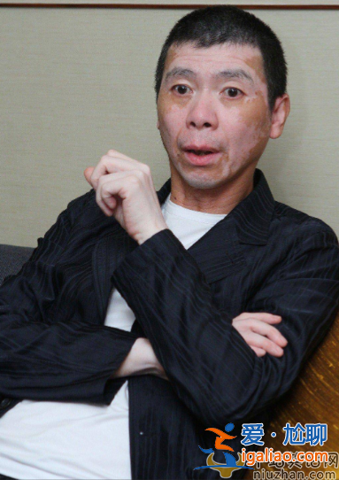 馮小剛白癜風(fēng)病怎么治好的?本人稱沒(méi)吃任何藥