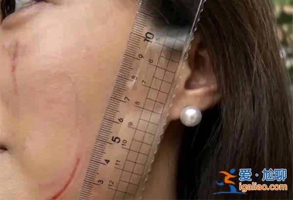 女法官抓傷女子面部 法院回應(yīng)？