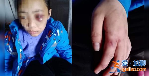 繼母涉嫌虐待繼女致殘疾，真的虐待致殘疾嗎[繼母虐待繼女]？