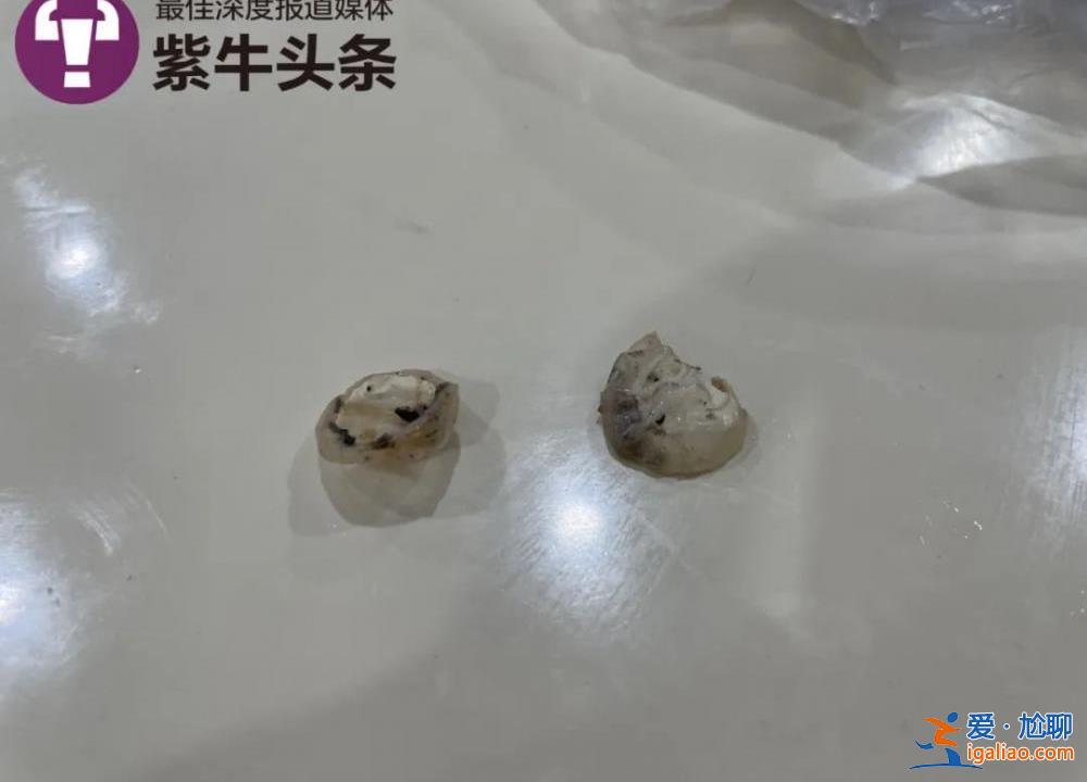 食堂飯菜異物是鴨子眼球鞏膜？現(xiàn)場(chǎng)實(shí)測(cè)鴨眼球鞏膜比鴨眼外表大數(shù)倍？