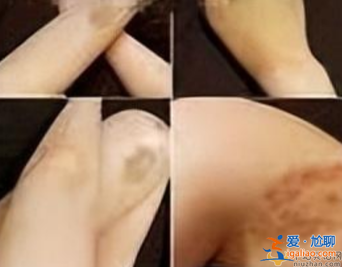 網(wǎng)紅蔡瑛紋被男友家暴致流產(chǎn)，控訴男方吃軟飯還劈腿